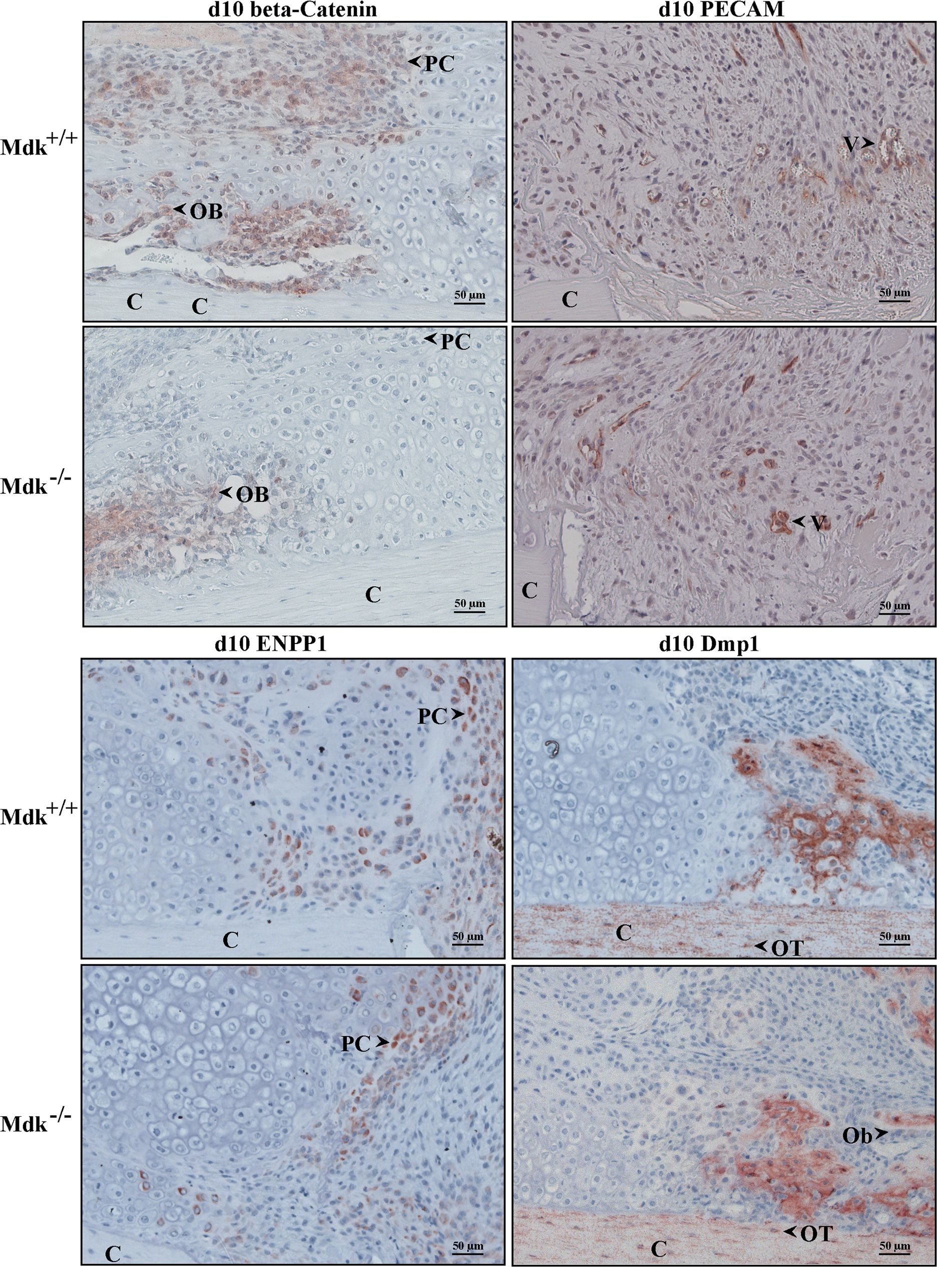 Fig.4.A showing Immunohistochemistry in a Mus musculus (House mouse) sample from the publication: Midkine-deficiency delays chondrogenesis during the early phase of fracture healing in mice.
