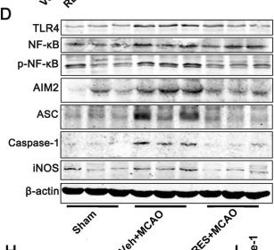Fig.4.D showing Western Blotting in a Rattus norvegicus (Rat) sample from the publication: Resveratrol attenuates pyroptosis and neuroinflammation by inhibiting the TLR4/NF-κB/AIM2 pathway in ischemic stroke rats.