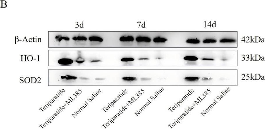 Fig.2.B showing Western Blotting from the publication: Teriparatide mitigates oxidative stress following spinal cord injury and enhances neurological recovery via the Nrf2/HO-1 signaling pathway.