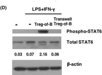Fig.4.D showing Western Blotting from the publication: M2-like macrophages polarized by Foxp3- Treg-of-B cells ameliorate imiquimod-induced psoriasis.