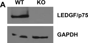 Fig.8.A showing Western Blotting from the publication: A new class of multimerization selective inhibitors of HIV-1 integrase.