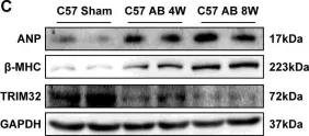 Fig.1.C showing Western Blotting in a Mus musculus (House mouse) sample from the publication: Tripartite motif 32 prevents pathological cardiac hypertrophy.