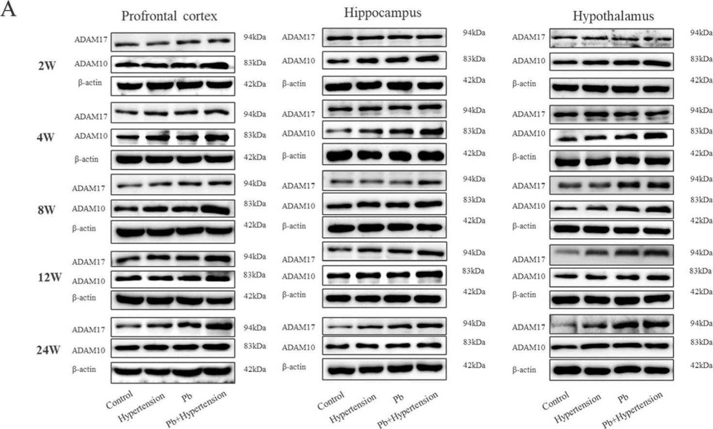 Fig.4.A showing Western Blotting in a Mus musculus (House mouse) sample from the publication: miR-26a-5p/ADAM17-Mediated Proteolysis of TREM2 Regulates Neuroinflammation in Hypertensive Mice Following Lead Exposure.