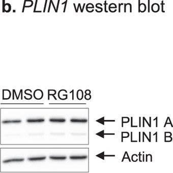 Epigenetic Regulation of PLIN 1 in Obese Women and its Relation to Lipolysis.