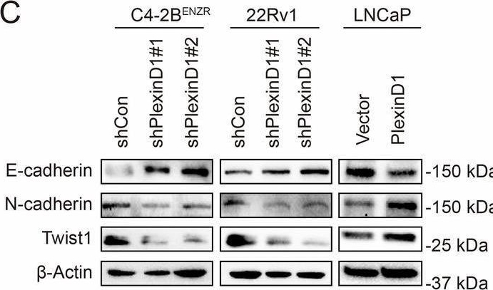 Fig.5.C showing Western Blotting from the publication: PlexinD1 is a driver and a therapeutic target in advanced prostate cancer.