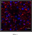 Fig.6.B showing Immunohistochemistry-immunofluorescence in a Rattus norvegicus (Rat) sample from the publication: Proteomic Analysis of the Rat Canalicular Membrane Reveals Expression of a Complex System of P4-ATPases in Liver.