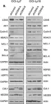 Fig.7.B showing Western Blotting in a Homo sapiens (Human) sample from the publication: Inhibition of COP9-signalosome (CSN) deneddylating activity and tumor growth of diffuse large B-cell lymphomas by doxycycline.