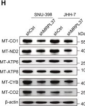 Fig.6.H showing Western Blotting from the publication: MRPL37 promotes hepatocellular carcinoma progression through modulating mitochondrial energy metabolism.