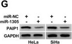 Fig.5.G showing Western Blotting in a Homo sapiens (Human) sample from the publication: Circ_0005576 Exerts an Oncogenic Role in Cervical Cancer via miR-1305-Dependent Regulation of PAIP1.