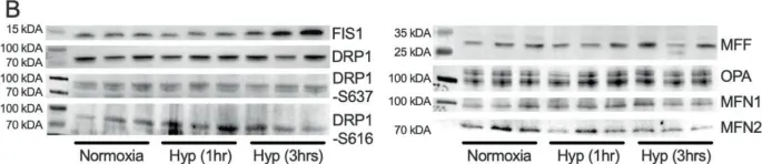 Fig.7.B showing Western Blotting from the publication: Naked mole-rat brown fat thermogenesis is diminished during hypoxia through a rapid decrease in UCP1.
