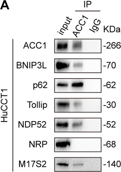 Fig.6.A showing Western Blotting from the publication: Pharmacological induction of acetyl-CoA carboxylase 1 autophagic degradation attenuates lipid accumulation and cholangiocarcinoma progression.