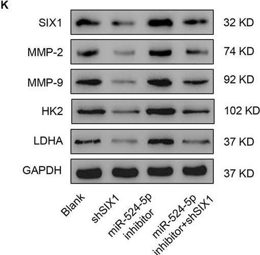 Fig.5.K showing Western Blotting in a Homo sapiens (Human) sample from the publication: Exosomal lncRNA TUG1 from cancer-associated fibroblasts promotes liver cancer cell migration, invasion, and glycolysis by regulating the miR-524-5p/SIX1 axis.