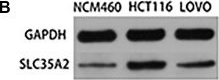 Fig.8.B showing Western Blotting from the publication: Comprehensive analysis of transcriptome data and experimental identification show that solute carrier 35 member A2 (SLC35A2) is a prognostic marker of colorectal cancer.