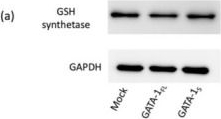 Fig.8.A showing Western Blotting from the publication: Exploring the Leukemogenic Potential of GATA-1S, the Shorter Isoform of GATA-1: Novel Insights into Mechanisms Hampering Respiratory Chain Complex II Activity and Limiting Oxidative Phosphorylation Efficiency.