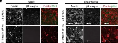 Fig.2.D showing Immunohistochemistry-immunofluorescence from the publication: CCM proteins control endothelial β1 integrin dependent response to shear stress.