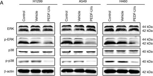 Fig.2.A showing Western Blotting from the publication: PEDF inhibits non‑small cell lung cancer proliferation by suppressing autophagy through downregulation of AMPK‑ULK1 signaling.