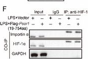 Fig.4.F showing Western Blotting from the publication: PEAR1 Promotes Glucose Metabolism Reprogramming in Sepsis-Associated Acute Lung Injury via AARS1-Mediated HIF-1α Lactylation.