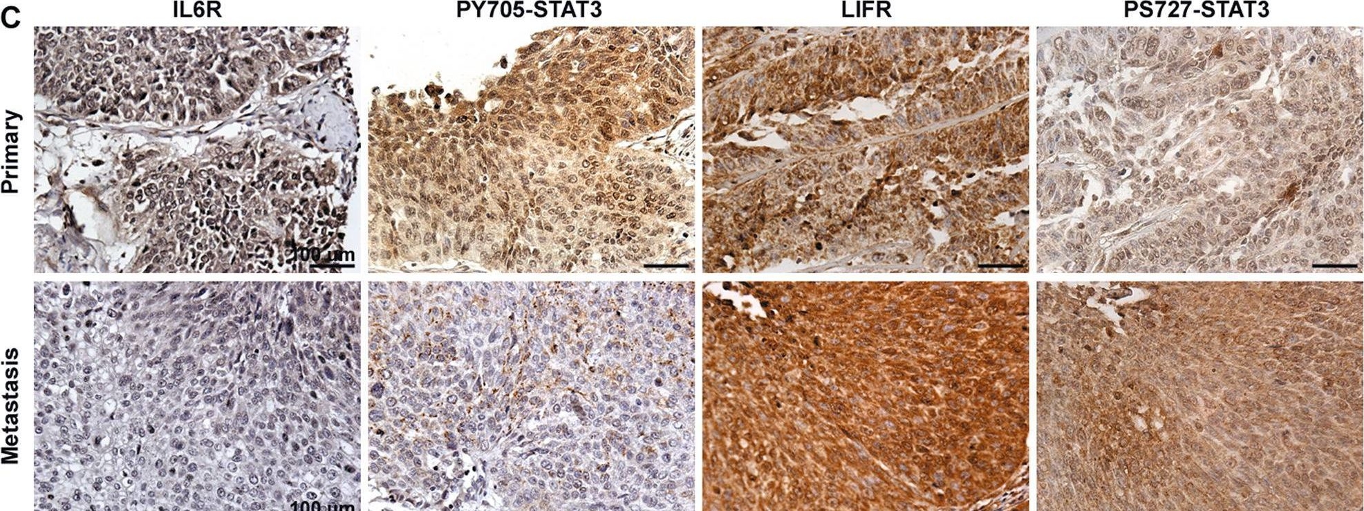 Fig.6.C showing Immunohistochemistry from the publication: STAT3 phosphorylation at Ser727 and Tyr705 differentially regulates the EMT-MET switch and cancer metastasis.