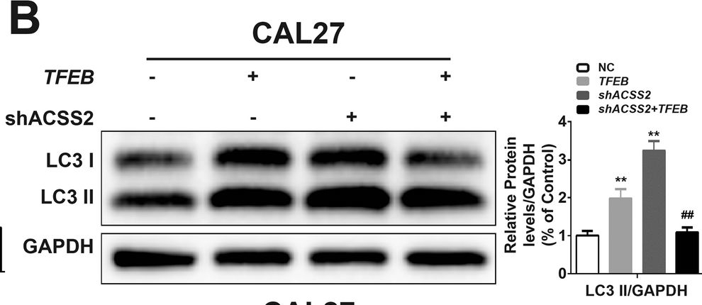 Fig.7.B showing Western Blotting in a Homo sapiens (Human) sample from the publication: ACSS2-TFEB axis acts as a critical regulator of the autophagic machinery in head and neck squamous cell carcinoma.