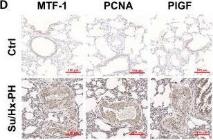 Fig.1.D showing Immunohistochemistry in a Rattus norvegicus (Rat) sample from the publication: Zinc-Induced PKCδ-dependent Phosphorylation of MTF-1 Promotes Pulmonary Vascular Remodeling in Hypoxic Pulmonary Hypertension.