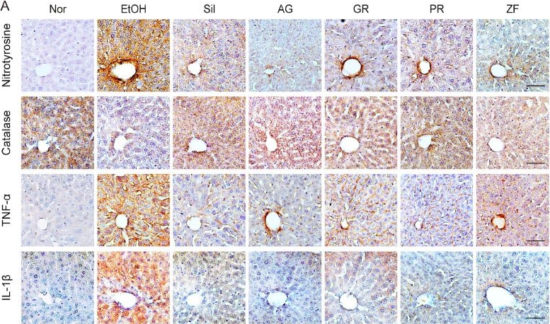 Fig.7.A showing Immunohistochemistry in a Mus musculus (House mouse) sample from the publication: Comparative Study on Hepatoprotective Effects of Traditional Herbs, Roots of Angelica gigas Nakai, Glycyrrhiza uralensis Fischer, Zizyphus jujuba Mill., and Fruits of Paeonia lactiflora Pall., on Ethanol-Induced Liver Injury in Mice.