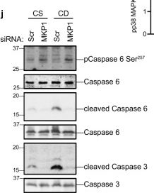 Fig.5.J showing Western Blotting from the publication: MKP1 promotes nonalcoholic steatohepatitis by suppressing AMPK activity through LKB1 nuclear retention.