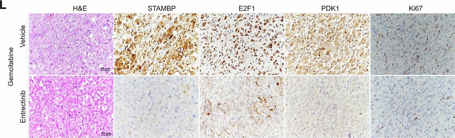 Fig.8.L showing Immunohistochemistry in a Mus musculus (House mouse) sample from the publication: Identification of STAM-binding protein as a target for the treatment of gemcitabine resistance pancreatic cancer in a nutrient-poor microenvironment.