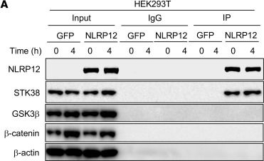 Fig.8.A showing Western Blotting in a Homo sapiens (Human) sample from the publication: NLRP12 downregulates the Wnt/β-catenin pathway via interaction with STK38 to suppress colorectal cancer.