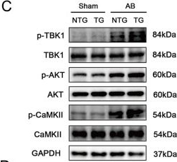 Fig.6.C showing Western Blotting from the publication: USP38 exacerbates pressure overload-induced left ventricular electrical remodeling.