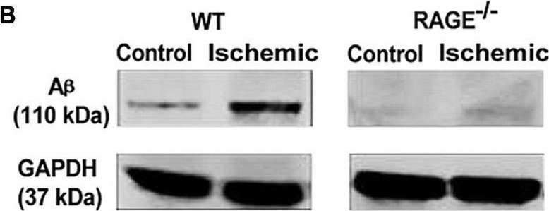 Fig.2.B showing Western Blotting in a Mus musculus (House mouse) sample from the publication: RAGE and its ligand amyloid beta promote retinal ganglion cell loss following ischemia-reperfusion injury.
