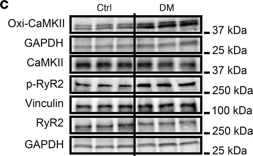 Fig.5.C showing Western Blotting in a Mus musculus (House mouse) sample from the publication: Macrophage IL-1β mediates atrial fibrillation risk in diabetic mice.