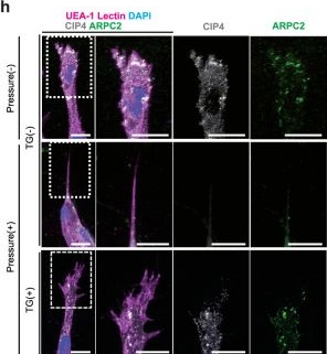 Fig.8.H showing Immunocytochemistry-immunofluorescence in a Mus musculus (House mouse) sample from the publication: Biomechanical control of vascular morphogenesis by the surrounding stiffness.