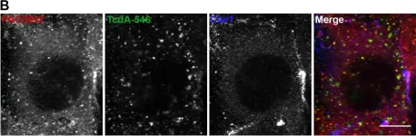 Fig.4.B showing Immunocytochemistry-immunofluorescence in a Mus musculus (House mouse) sample from the publication: Clostridium difficile Toxin A Undergoes Clathrin-Independent, PACSIN2-Dependent Endocytosis.