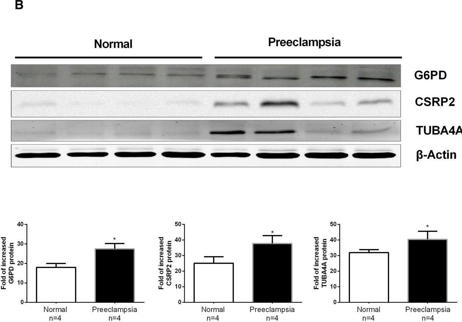 Fig.2.B showing Western Blotting from the publication: iTRAQ-based quantitative proteomic analysis of thoracic aortas from adult rats born to preeclamptic dams.