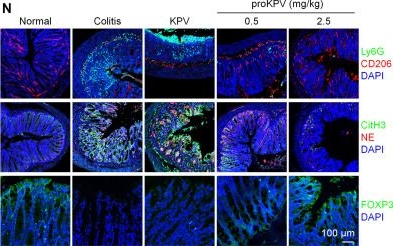 Fig.4.N showing Immunohistochemistry-immunofluorescence from the publication: Inflammation-triggered self-immolative conjugates enable oral peptide delivery by overcoming gastrointestinal barriers.