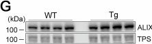 Fig.12.G showing Western Blotting in a Mus musculus (House mouse) sample from the publication: Mitochondrial protein import stress causes lysosomal damage and progressive tissue atrophy.