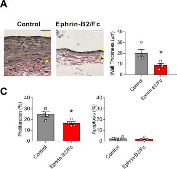 Fig.2.A showing Immunohistochemistry in a Mus musculus (House mouse) sample from the publication: Eph-B4 regulates adaptive venous remodeling to improve arteriovenous fistula patency.