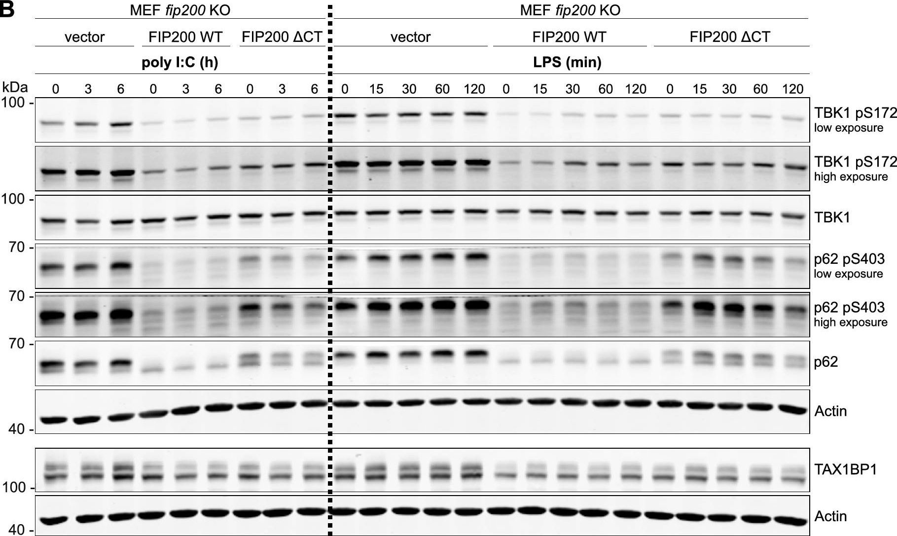 FIP200 controls the TBK1 activation threshold at SQSTM1/p62-positive condensates.