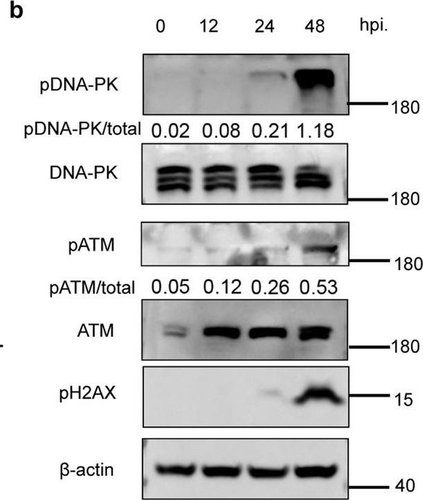 Fig.4.B showing Western Blotting in a Homo sapiens (Human) sample from the publication: Non-small cell lung cancers (NSCLCs) oncolysis using coxsackievirus B5 and synergistic DNA-damage response inhibitors.