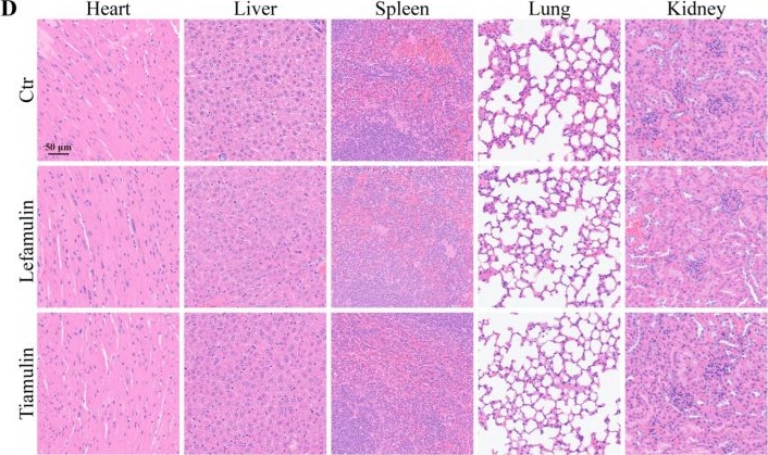 Fig.4.D showing Immunohistochemistry from the publication: Pleuromutilins Suppress Hepatocellular Carcinoma Growth via ABCA1 Inhibition-Induced Cholesterol Accumulation.
