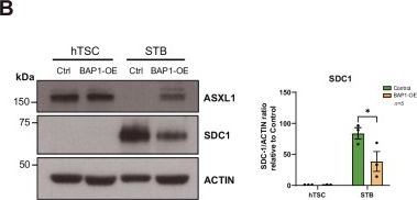 Fig.4.B showing Western Blotting in a Homo sapiens (Human) sample from the publication: BAP1 dysregulation impairs trophoblast differentiation and contributes to placental dysfunction in preeclampsia.