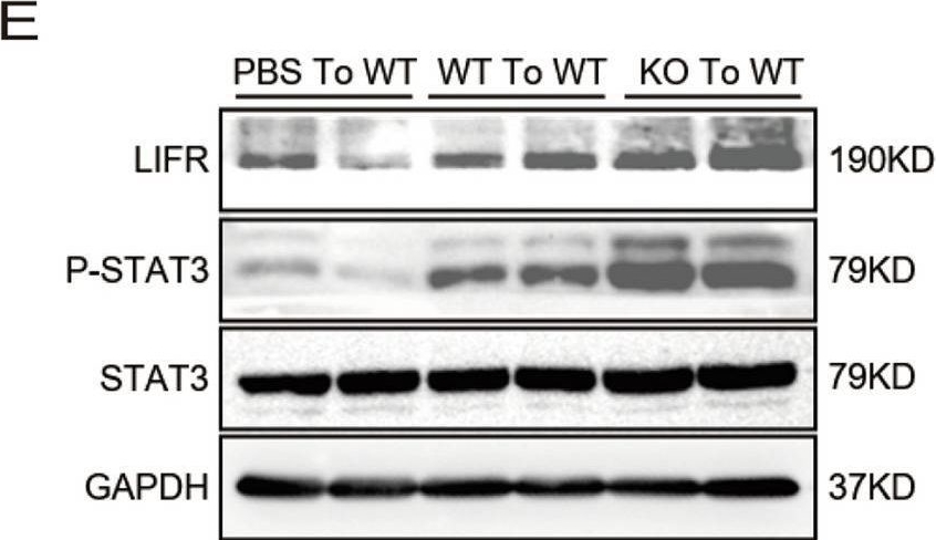 Fig.7.E showing Western Blotting from the publication: OSMR deficiency aggravates pressure overload-induced cardiac hypertrophy by modulating macrophages and OSM/LIFR/STAT3 signalling.