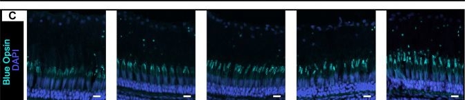 Fig.4.C showing Immunohistochemistry-immunofluorescence from the publication: Abca4, mutated in Stargardt disease, is required for structural integrity of cone outer segments.