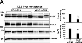 Fig.6.A showing Western Blotting from the publication: Vasodilator-stimulated phosphoprotein promotes liver metastasis of gastrointestinal cancer by activating a β1-integrin-FAK-YAP1/TAZ signaling pathway.