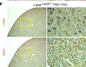 Fig.3.F showing Immunohistochemistry in a Mus musculus (House mouse) sample from the publication: Transcription factor c-Maf deletion improves streptozotocin-induced diabetic nephropathy by directly regulating Sglt2 and Glut2.