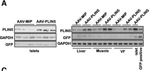 Perilipin5 protects against lipotoxicity and alleviates endoplasmic reticulum stress in pancreatic β-cells.