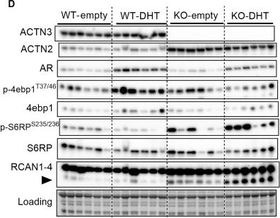 Fig.4.D showing Western Blotting in a Mus musculus (House mouse) sample from the publication: ACTN3 genotype influences androgen response in developing murine skeletal muscle.