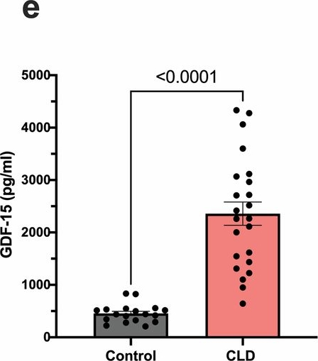 Fig.1.E showing Enzyme-linked immunosorbent assay from the publication: Accelerated aging of skeletal muscle and the immune system in patients with chronic liver disease.