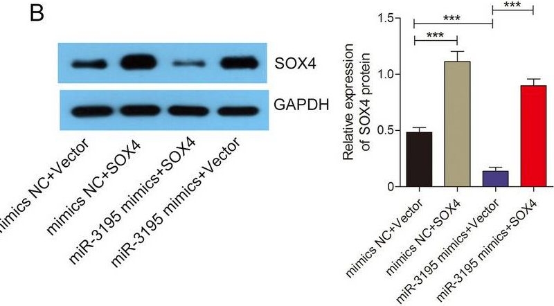 Fig.5.B showing Western Blotting in a Homo sapiens (Human) sample from the publication: miR-3195 suppresses the malignant progression of osteosarcoma cells via targeting SOX4.