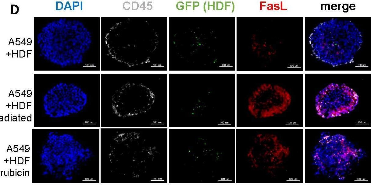 Fig.4.D showing Immunocytochemistry-immunofluorescence from the publication: Senescent human fibroblasts have increased FasL expression and impair the tumor immune response.